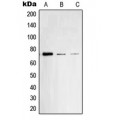LifeSab™ SYK (pY348) Rabbit pAb (50 µl)