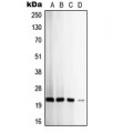 LifeSab™ TIMP2 Rabbit pAb (50 µl)
