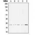 LifeSab™ cTnI Rabbit pAb (50 µl)