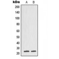 LifeSab™ TCTP Rabbit pAb (50 µl)