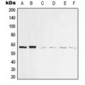 LifeSab™ Vimentin Rabbit pAb (50 µl)