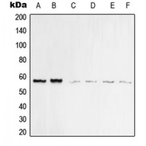 LifeSab™ Vimentin Rabbit pAb (50 µl)