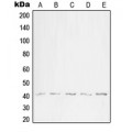 LifeSab™ WNT1 Rabbit pAb (50 µl)