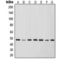 LifeSab™ IKK gamma Rabbit pAb (50 µl)