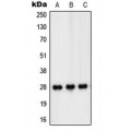 LifeSab™ PEX11B Rabbit pAb (50 µl)
