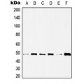 LifeSab™ Histone Deacetylase 3 Rabbit pAb (50 µl)