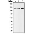 LifeSab™ Histone Deacetylase 5 (pS498) Rabbit pAb (50 µl)