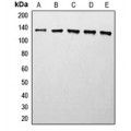LifeSab™ Histone Deacetylase 5 Rabbit pAb (50 µl)