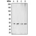 LifeSab™ BCKDK Rabbit pAb (50 µl)