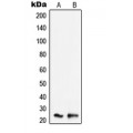 LifeSab™ SCC-S2 Rabbit pAb (50 µl)