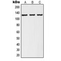 LifeSab™ RANBP6 Rabbit pAb (50 µl)