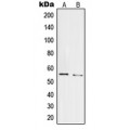 LifeSab™ PRPF19 Rabbit pAb (50 µl)