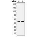 LifeSab™ IPPK Rabbit pAb (50 µl)