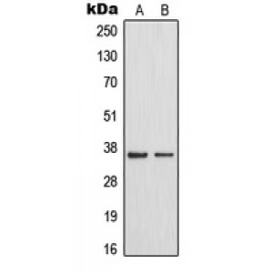 LifeSab™ MAST4 Rabbit pAb (50 µl)