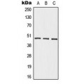 LifeSab™ Beta-2 Adrenergic Receptor Rabbit pAb (50 µl)