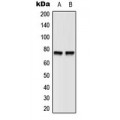 LifeSab™ BTK (pY551) Rabbit pAb (50 µl)