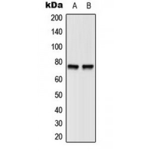 LifeSab™ BTK (pY551) Rabbit pAb (50 µl)
