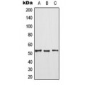 LifeSab™ TPL2 (pT290) Rabbit pAb (50 µl)