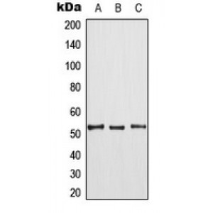 LifeSab™ TPL2 (pT290) Rabbit pAb (50 µl)