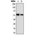 LifeSab™ ATF2 (pS112) Rabbit pAb (50 µl)