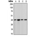 LifeSab™ CK1 alpha Rabbit pAb (50 µl)