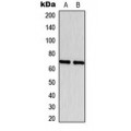 LifeSab™ Estrogen Receptor alpha Rabbit pAb (50 µl)
