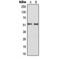 LifeSab™ HNF4 alpha (pS313) Rabbit pAb (50 µl)