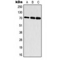 LifeSab™ S6K1 (pT444) Rabbit pAb (50 µl)