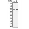 LifeSab™ STAT6 (pY641) Rabbit pAb (50 µl)