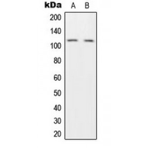 LifeSab™ HGS Rabbit pAb (50 µl)