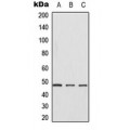 LifeSab™ CK1 gamma 1 Rabbit pAb (50 µl)