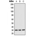 LifeSab™ CK1 alpha Rabbit pAb (50 µl)