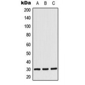 LifeSab™ CK1 alpha Rabbit pAb (50 µl)