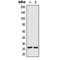 LifeSab™ SIAH1/2 Rabbit pAb (50 µl)