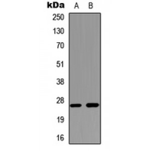 LifeSab™ Aquaporin 2 Rabbit pAb (50 µl)