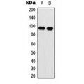 LifeSab™ EEF2 (pT56) Rabbit pAb (50 µl)