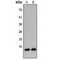 LifeSab™ Histone H2B (AcK12) Rabbit pAb (50 µl)