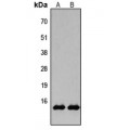 LifeSab™ Histone H2B (AcK15) Rabbit pAb (50 µl)