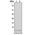 LifeSab™ Histone H4 (AcK16) Rabbit pAb (50 µl)