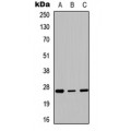 LifeSab™ HOXC6 Rabbit pAb (50 µl)
