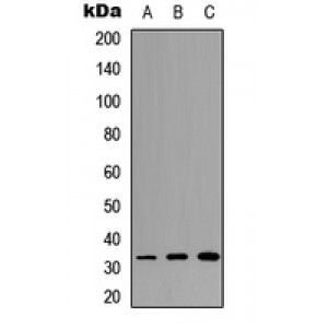 LifeSab™ RPS6 Rabbit pAb (50 µl)