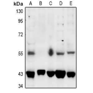 LifeSab™ SGK1/2 (pT256/253) Rabbit pAb (50 µl)