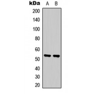 LifeSab™ SGK1 Rabbit pAb (50 µl)