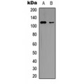 LifeSab™ Vinculin Rabbit pAb (50 µl)
