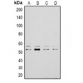 LifeSab™ LYN Rabbit pAb (50 µl)