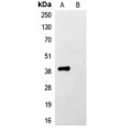 LifeSab™ His-tag Rabbit pAb (50 µl)