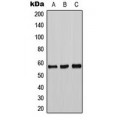 LifeSab™ Tyrosine Hydroxylase Rabbit pAb (50 µl)