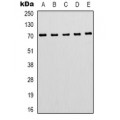 LifeSab™ Hepatitis B Virus Surface Antigen Mouse mAb (50 µl)