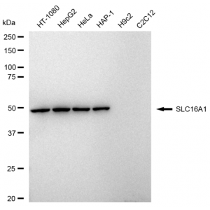 LifeSab™ SLC16A1 Rabbit mAb (20 μl)