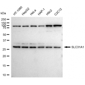 LifeSab™ SLC31A1 Rabbit mAb (20 μl)